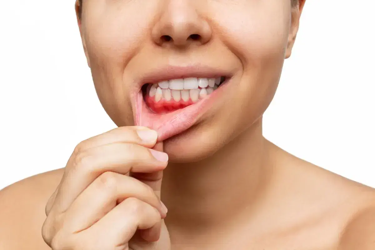 Què és la malaltia periodontal