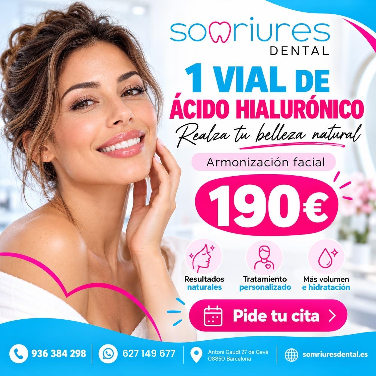 Facial harmonization: 1 vial of hyaluronic acid for €190