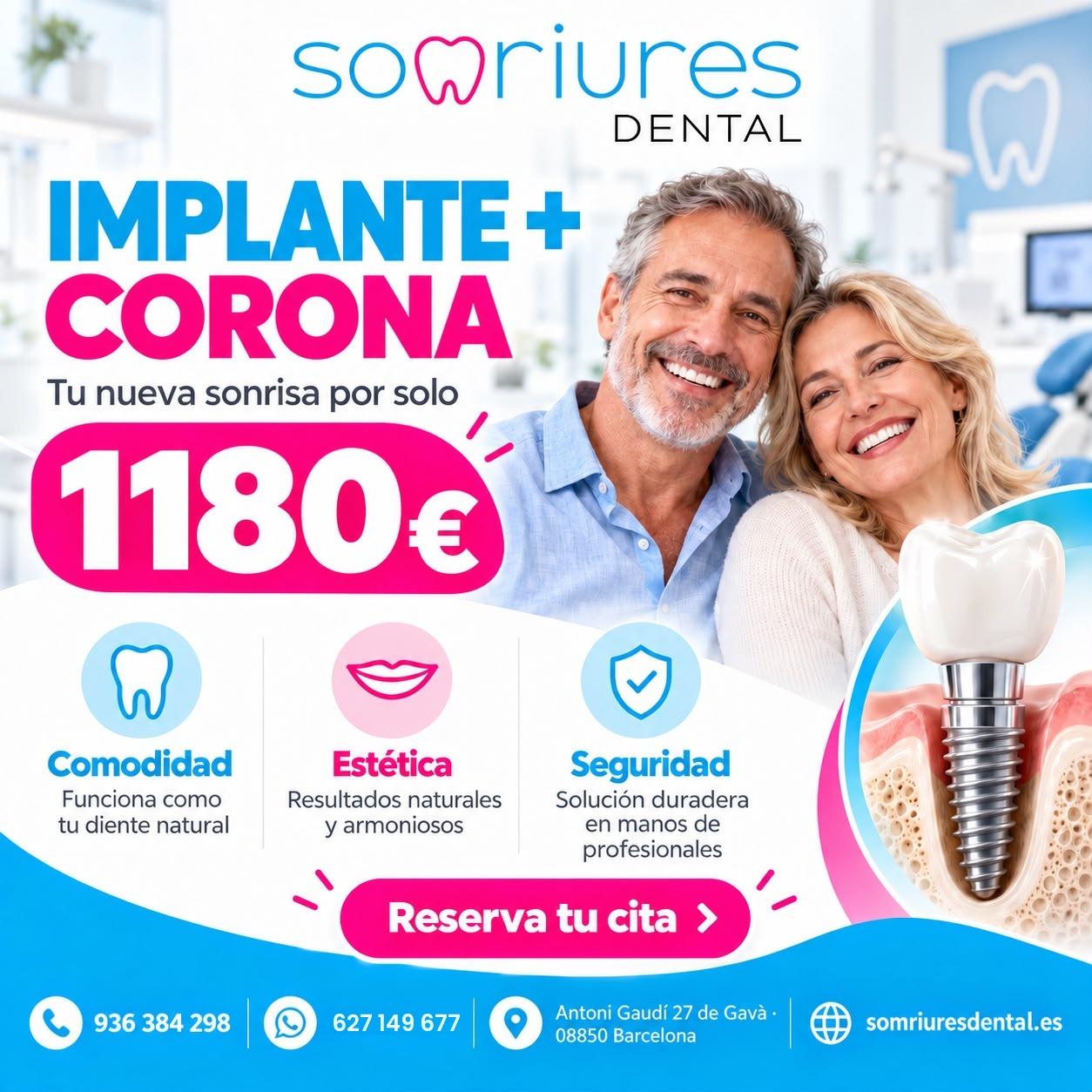 Dental implant + crown for €1,180